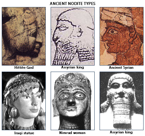 Ancient Nodite types